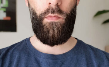 Transplantacja włosów – kiedy warto się na nią zdecydować? Transplantacja włosów – kiedy warto się na nią zdecydować